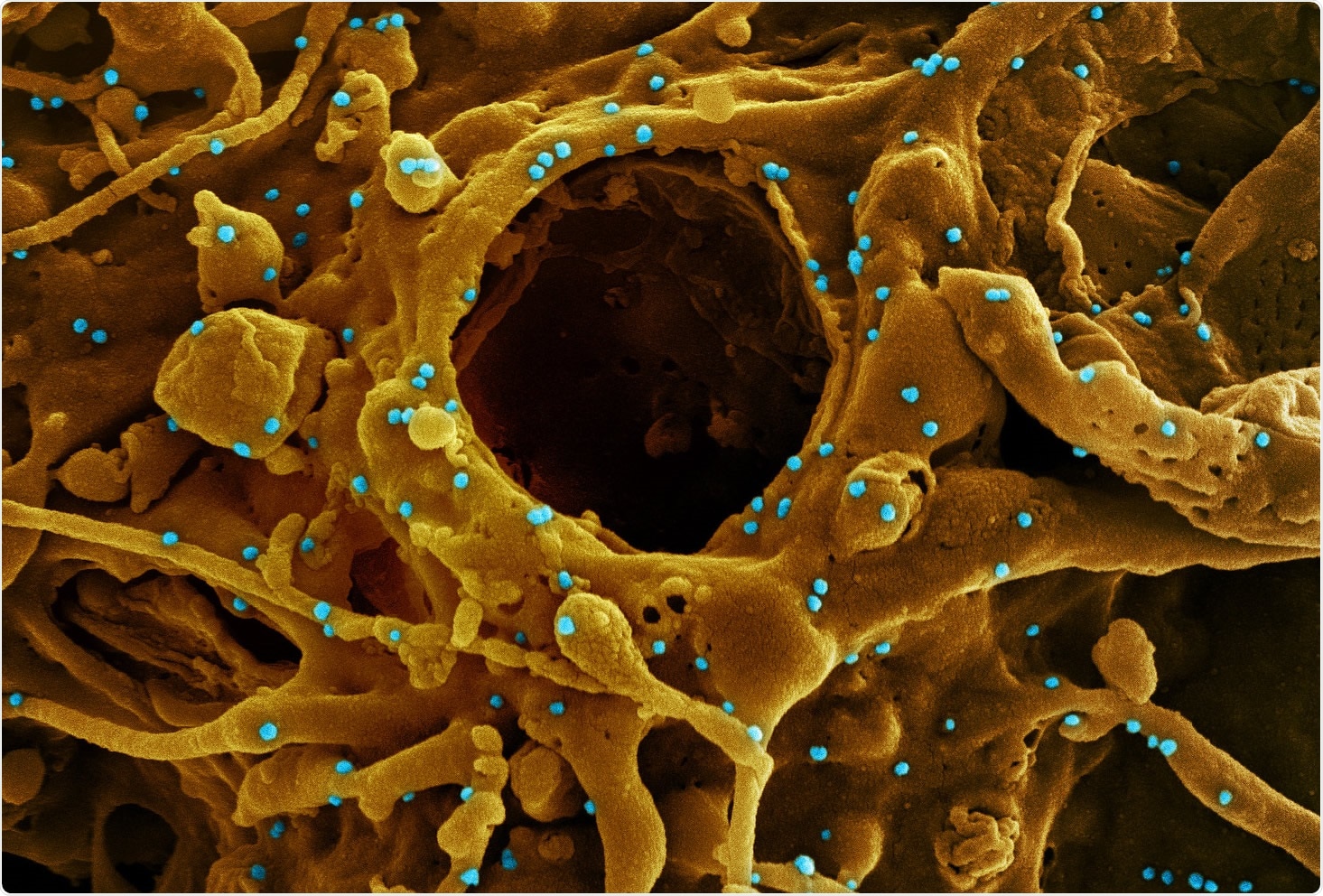 Study: Viral loads of Delta-variant SARS-CoV2 breakthrough infections following vaccination and booster with the BNT162b2 vaccine. Image Credit: NIAID