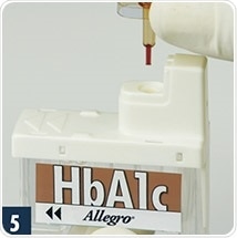 Replace capillary sampler.