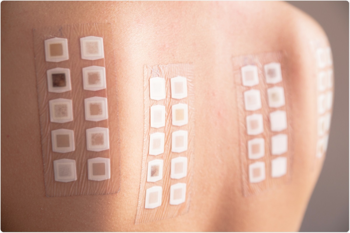 Study:Adverse reactions to BNT162b2 mRNA COVID-19 vaccine in medical staffs with a history of allergy. Image Credit: Neeila/ Shutterstock