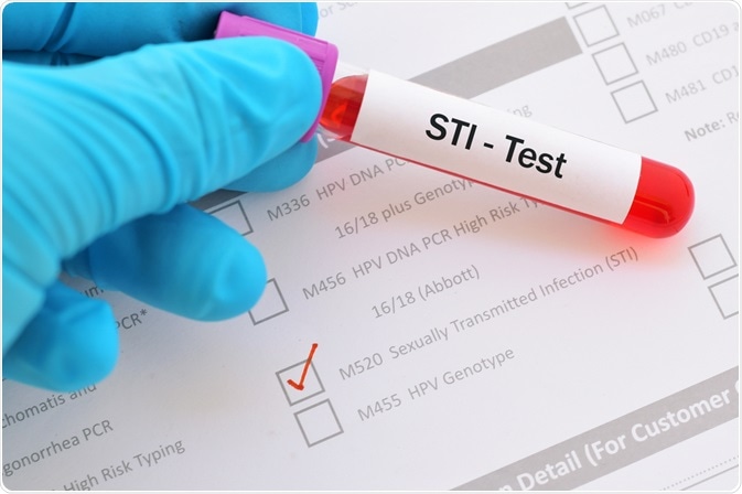 STI Test STI Test