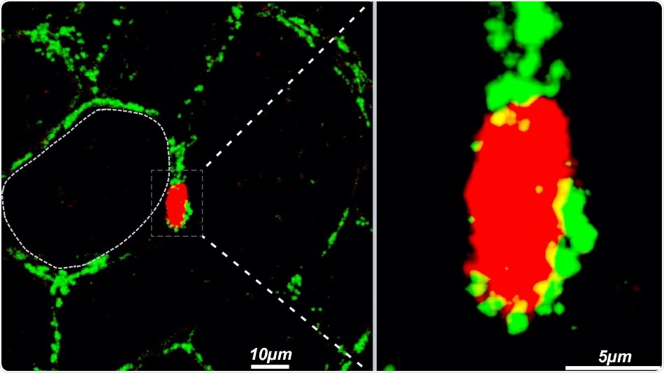 US Research reveals the role of Heparan Sulfate in obesity