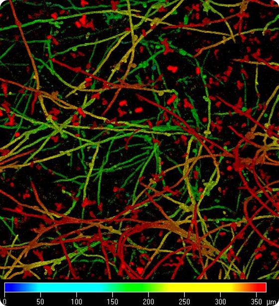 Candida species growing as biofilms on catheter material