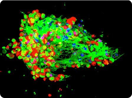 Ferri Cools Lartigue