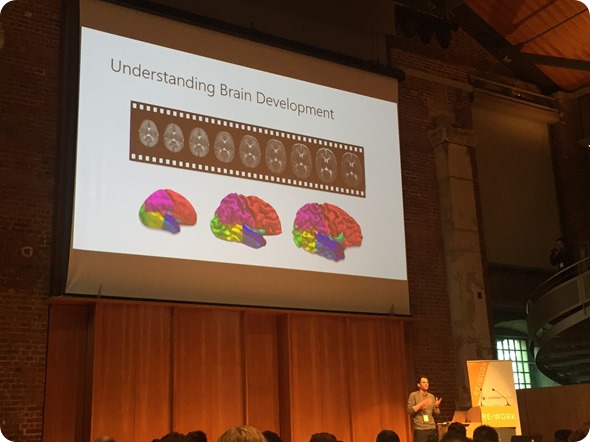 Fetal Brain Development