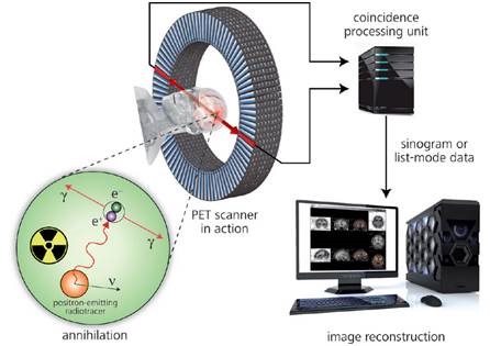 Principle of positron emission tomography