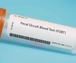 Blood In Stool: What It Means And Why You Should Act