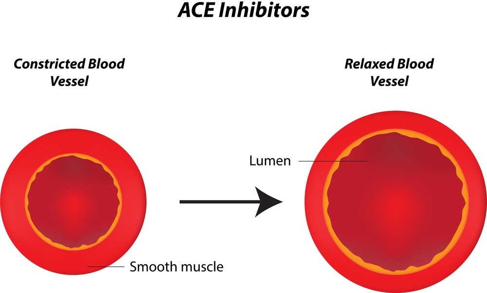 ACE Inhibitors