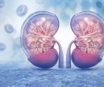What is Nephrotoxicity?