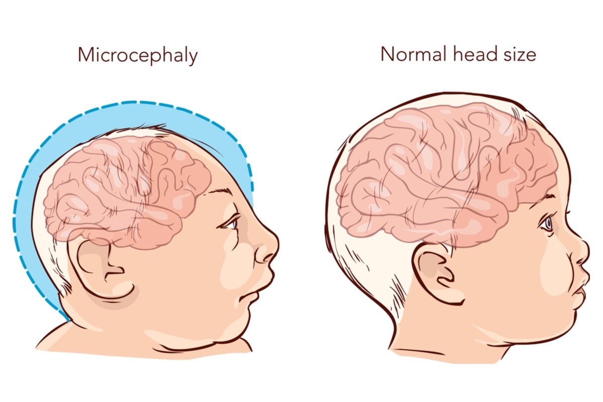 Image Credit: Drp8/Shutterstock