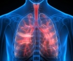 An Overview of Pleural Diseases