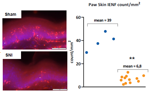 Mean IENF count in the ipsilateral paw skin 7 days after surgery. Left: representative images of PGP9.5-stained samples from skin.