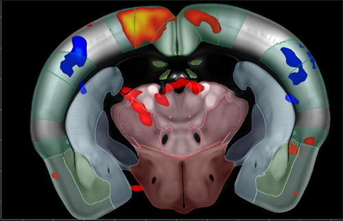 Functional ultrasound (fUS) imaging outline. fUS GLM map of brain response to pinprick.