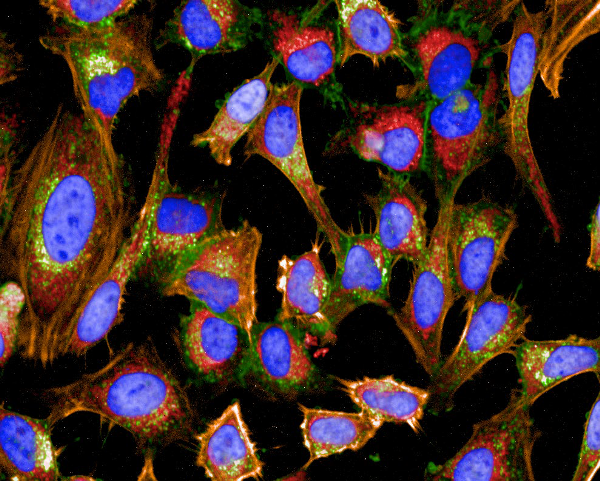 Cells with added coloring to make details distinct. (purple, yellow, green, red)