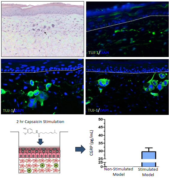 Development and characterisation of a neurosensory skin model