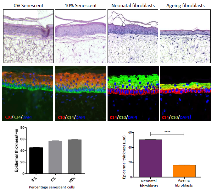 Epidermal-dermal cross-talk influences epidermal morphology during ageing