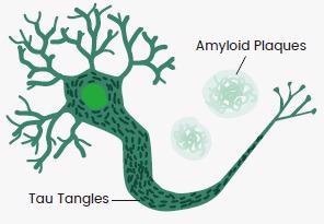 Discovering new drug targets for neurodegenerative diseases