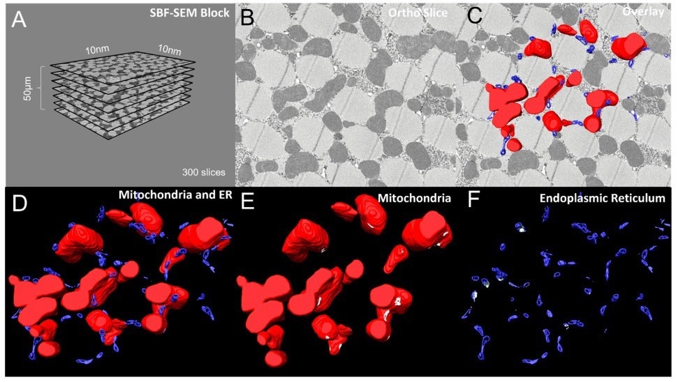 Using Amira Software to measure 3D organelle morphology