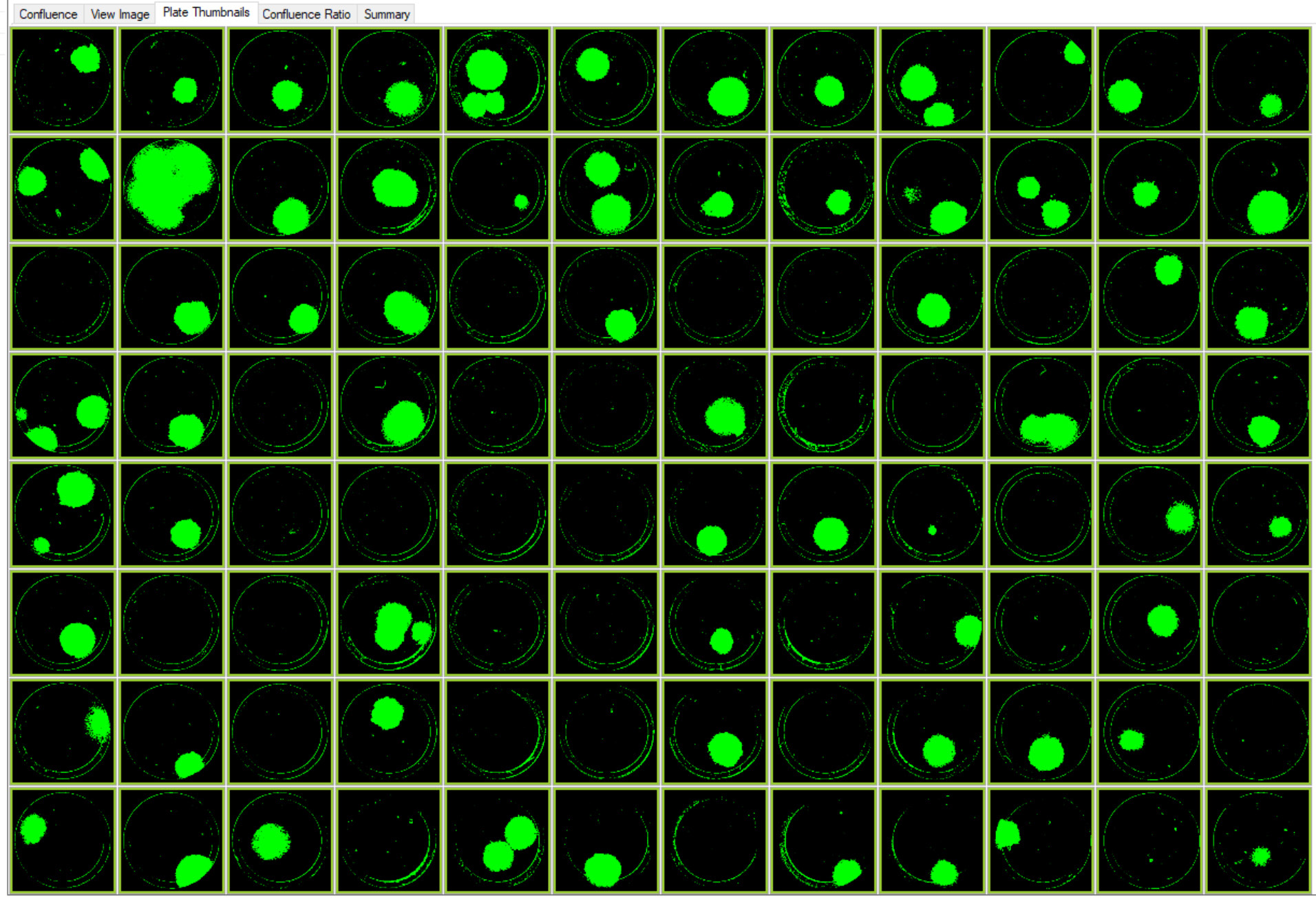 Images of colonies of single-cell printed CRISPR edited cells with RFP marker. This plate layout image of a 96–well Costar 3300 plate with cells on Day 9 was acquired using CSI-FL at 4X.