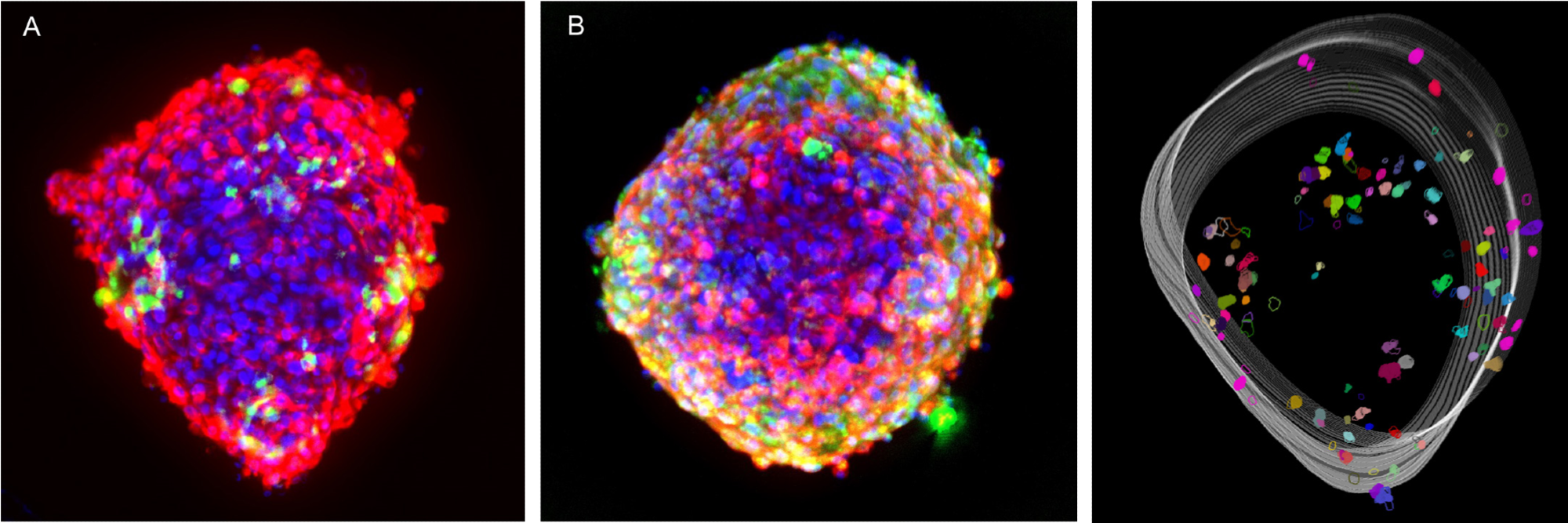How does the FLIPR Penta System Allow for Better Resolution Calcium Oscillation Patterns in Cardiomyocytes? How does the FLIPR Penta System Allow for Better Resolution Calcium Oscillation Patterns in Cardiomyocytes?
