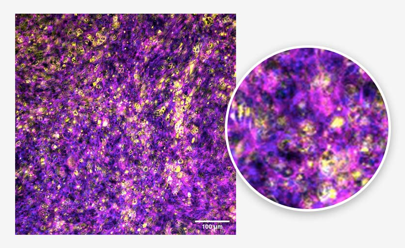 Alveolar epithelium. Tissue generated using the CN Bio PhysioMimix® OOC and Barrier (MPS-T12) Plates. ATII cells (yellow), actin cytoskeleton (magenta), and nuclei (blue) are indicated.
