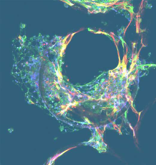 Making drug discovery more efficient by using human organ models