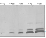 Identifying proteins through Next-Generation Protein Sequencing™ of proteins digested in-gel