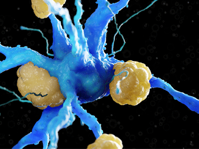 Tau protein in red and yellow.