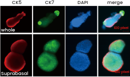 Mouse bladder organoids after 14 days in culture. Data provided by Dr. Yin at Washington University, St. Louis, MO.