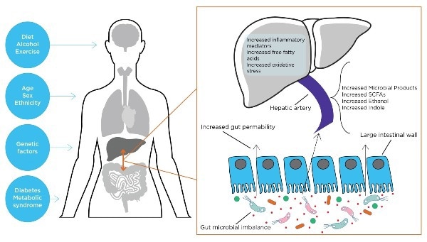 What are the links between liver disease and the microbiome?