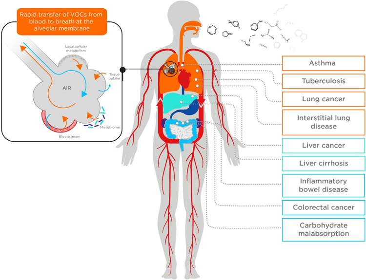 A summary of the mechanism through which VOCs originating from within the body end up in the breath, and some example disease areas that breath VOC analysis has been used for biomarker discovery.