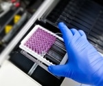 Common ELISA mistakes and how automation can help eliminate them