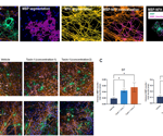 How iPSCs are revolutionizing myelination models for multiple sclerosis drug discovery?