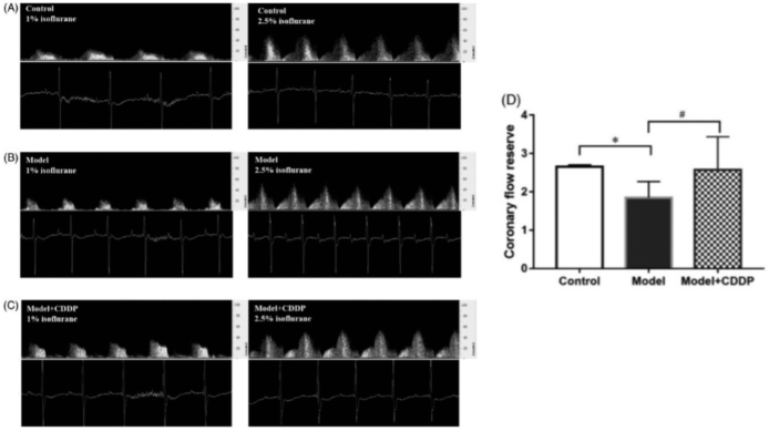 Publication 1. Pretreatment with compound Danshen dripping pills rescued coronary flow reserve capacity compared to lipid infusion-induced microvascular dysfunction mouse model. Coronary flow velocity imaging at baseline (left image) and hyperemic (right) for A) control c mouse, B) lipid infusion-induced microvascular dysfunction mouse model, and C) lipid infusion-induced microvascular dysfunction mouse model pretreated with compound Danshen dripping pills with D) aggregated results. *p < 0.05