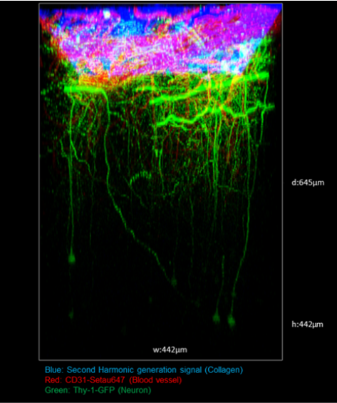 Two-Photon Brain Imaging in CIW-Implanted Thy1-M-GFP Mice