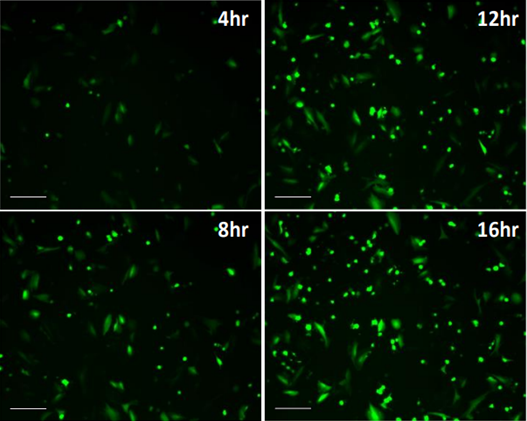Time-lapse image of EGFP expression following pCMV GFP plasmid transfection (Scale bar, 200 μm). The images were collected every 2 hr for 40 hr