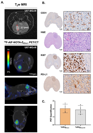 (A) T2-weighted MRI scans of intravenous injections of 18F-AlF-NOTA-ZPD-L1 1 h postinjection in U87-MGvIII orthotopic tumours. The mice received 0.2-0.76 MBq of radioconjugate. (B) shows histopathological validation of the tumour vascularisation ( CD31), location (HE), proliferation status (Ki67) and PD-L1 expression. (C) PET quantification of 18F-AlF-NOTA-ZPD-L1 tumour uptake
