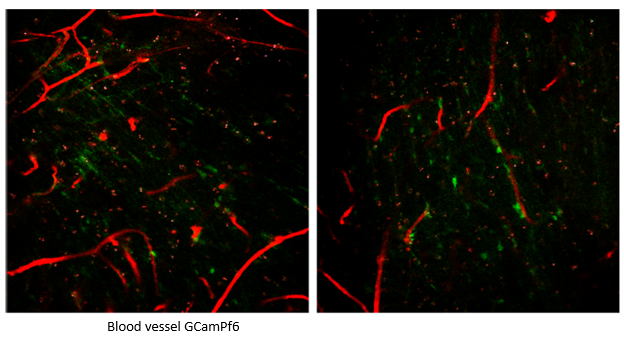 Two-Photon Hippocampal CA1 Imaging in CIC-Implanted Mice