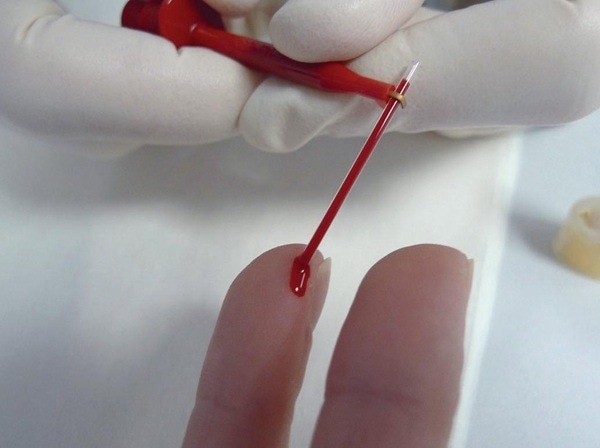 Capillary blood testing