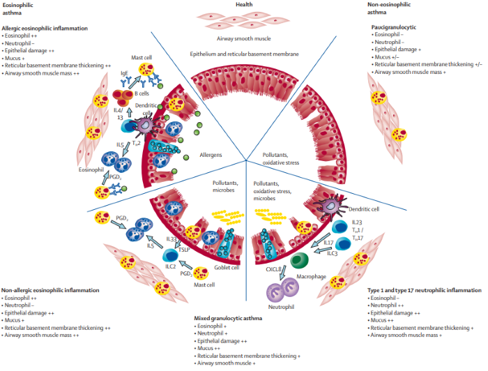 Mechanisms and characteristic pathological features of asthma immunopathology