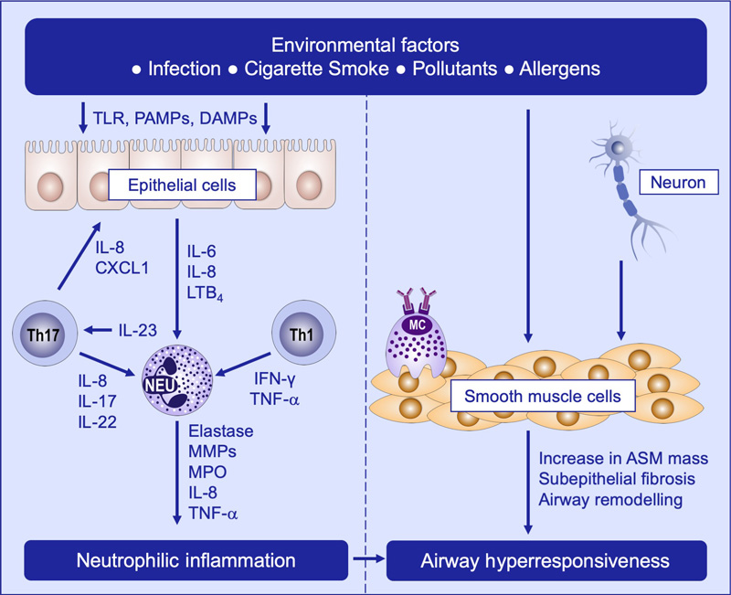 Mechanisms of non-T2 asthma, including neutrophilic inflammation and airway hyperresponsiveness.