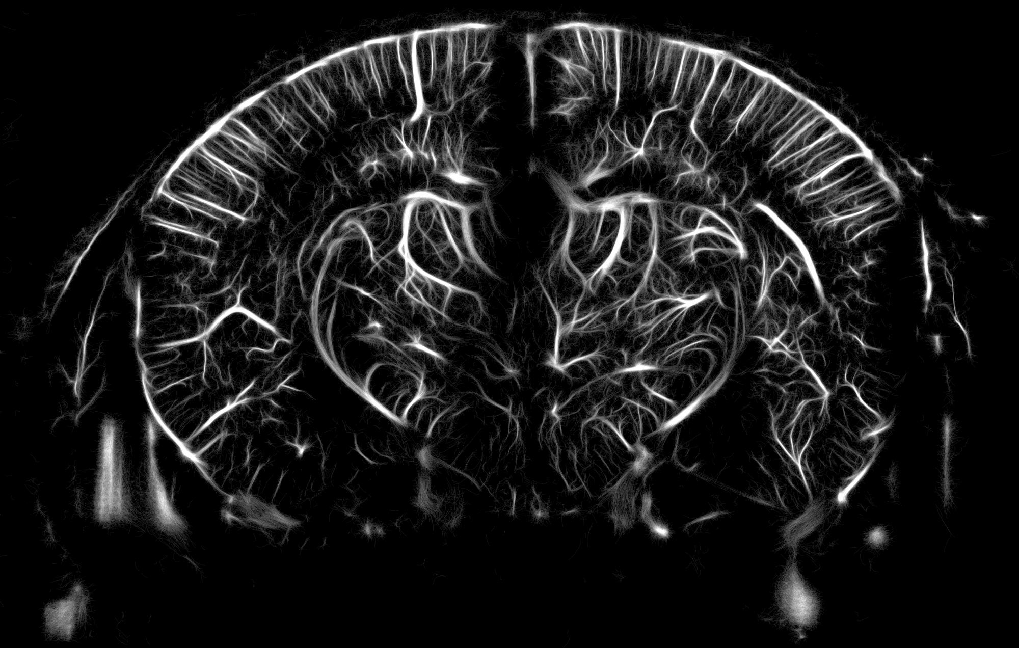 Brain mapping enabled by ultrafast doppler imaging
