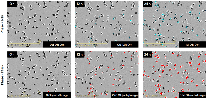 Real-Time Visualization and Quantification of Non-Adherent Jurkat Cell Death in Response to the Anti-Cancer Drug Camptothecin (CMP) Using the Incucyte<sup>®</sup> Live-Cell Analysis System