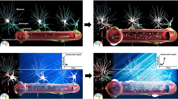 Mapping brain networks using functional ultrasound