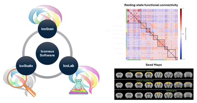 Mapping brain networks using functional ultrasound
