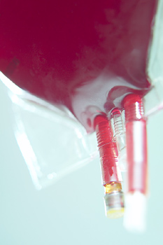 White blood cell (WBC) count may predict cardiovascular events and risk of death in postmenopausal women who are not currently identified by traditional cardiovascular risk factors, according to an article in the March 14 issue of Archives of Internal Medicine.