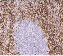 Potentiated CD16 activated ADCC CAR-NK cells