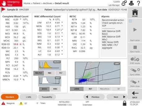Atellica HEMA 570 and 580 Analyzers to meet the hematology testing needs