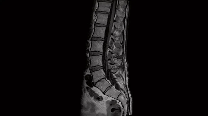 80 cm bore MAGNETOM Free.Max