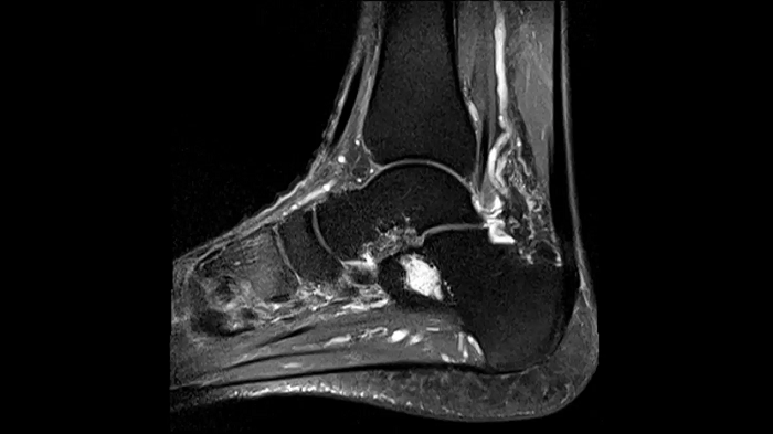 80 cm bore MAGNETOM Free.Max