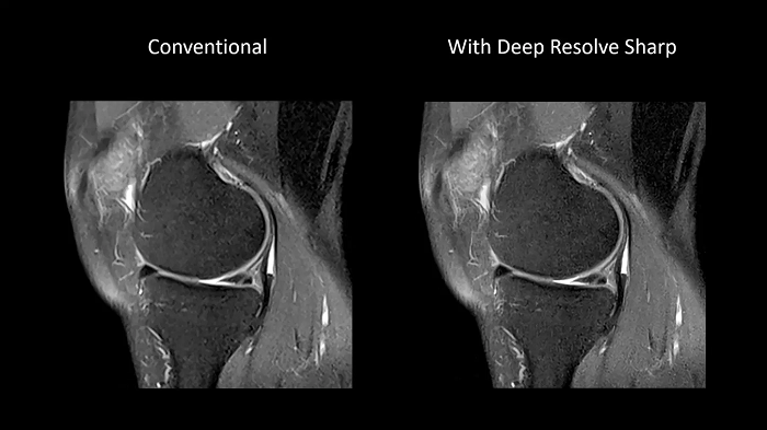 80 cm bore MAGNETOM Free.Max
